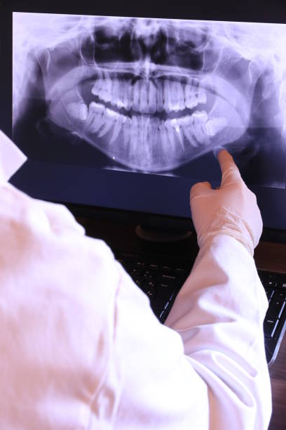 Best Dental Abscess Treatment in Bloomfield, NY