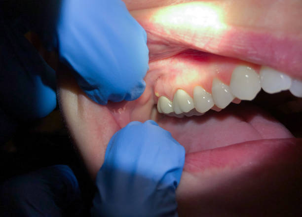 Best Emergency Treatment for Jaw Pain or Injury in Bloomfield, NY